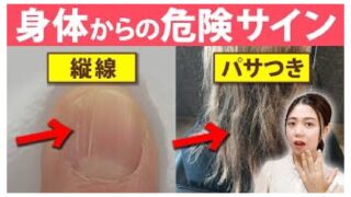 【体質改善】これに当てはまる人は要注意！体内に◯◯が不足している合図5選を解説します！