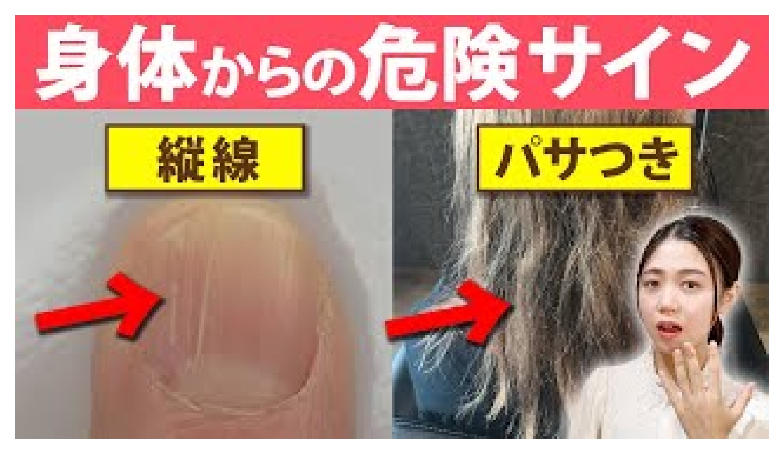 【体質改善】これに当てはまる人は要注意！体内に◯◯が不足している合図5選を解説します！